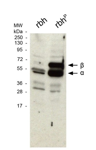 CaMKII (pTHR286 OR 287) pAB IgG