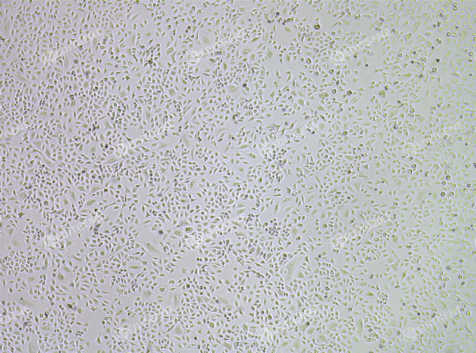 [EDITGENE 공식대리점 관련 업무대행/수입] PBRM1 Knockout A549 Cell Line