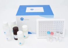 Human IL-1β(Interleukin 1 Beta) ELISA Kit