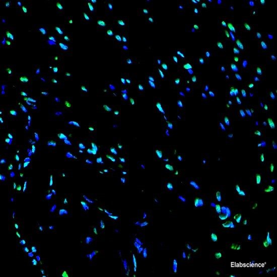One-step TUNEL In Situ Apoptosis Kit (Green, FITC)